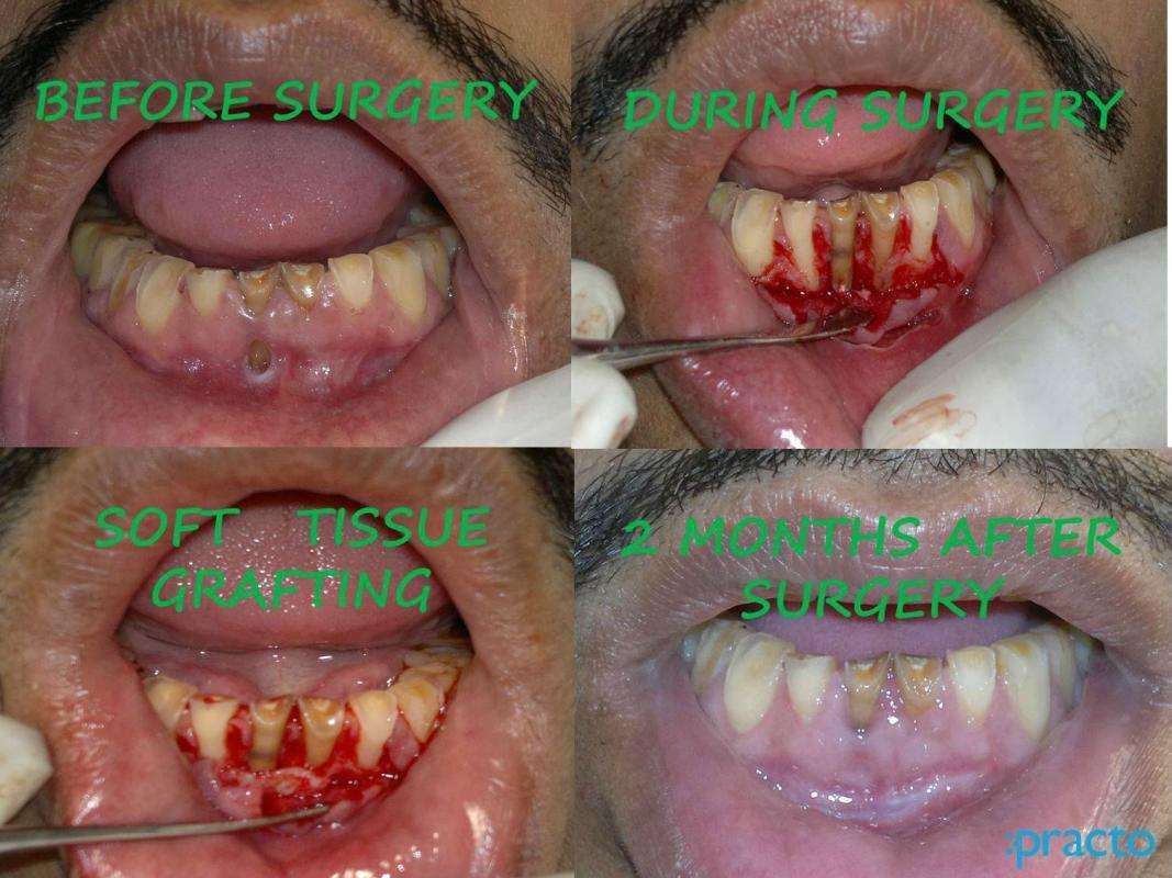 32Shine Dental Clinic, Palam Vihar preview 2