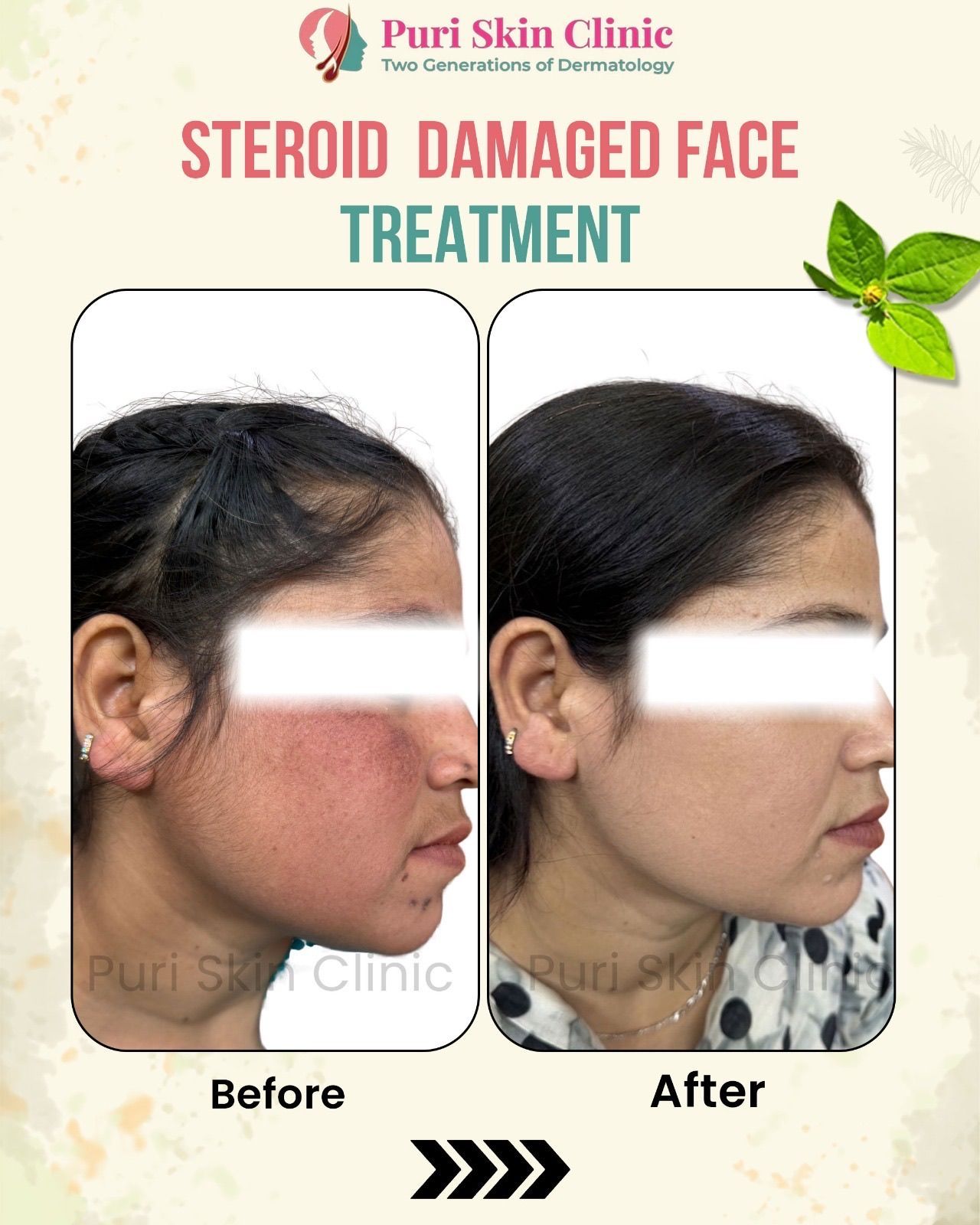 Dr. Gurinderjit Singh preview 3