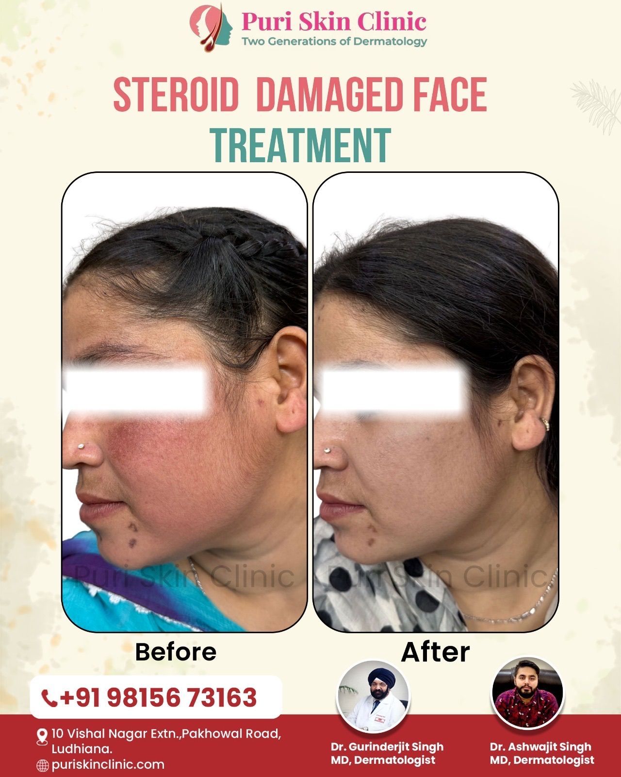 Dr. Gurinderjit Singh preview 2